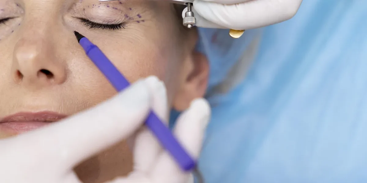 Complicaciones después de una cirugía de párpados – Costa Rica Complicaciones después de una cirugía de párpados | How are complications managed after eyelid surgery? - Costa Rica